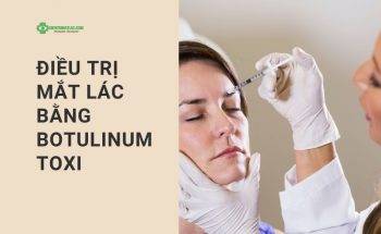 Điều trị mắt lác bằng botulinum toxi là gì?